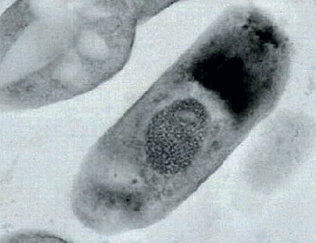 Mikrospkopische Aufnahme von Bakterien